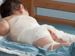В хирургию Камышинской детской больницы доставлен 10-месячный мальчик, обварившийся кипятком