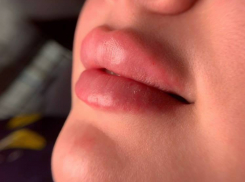 Камышан не вдохновили «губы по сниженной цене»