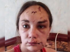 28-летнего негодяя отдадут под суд за «неизгладимое обезображивание  лица» молодой жены-красавицы