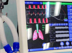 В Волгограде купили аппараты искусственной вентиляции легких, которые загорелись в Санкт-Петербурга и Москве