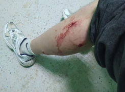 «Пожалуйста, примите уже какие-то меры относительно бездомных собак», - камышанина искусали три бродячих пса