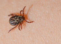 Врачи спасают жизнь 32-летнему жителю Волгоградской области с крымской лихорадкой, раздавившему пальцами клеща