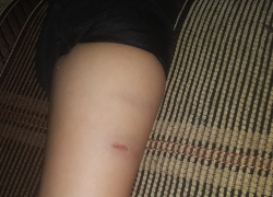 Я в шоке: когда у "Победы" истребят бродячих собак, которые покусали моего сына? - камышанка