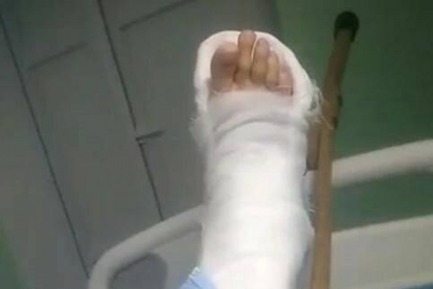 Камышанке «подперли» сломанную ногу костылем, а обезболивающего в ЦГБ Камышина не нашлось (ВИДЕО)