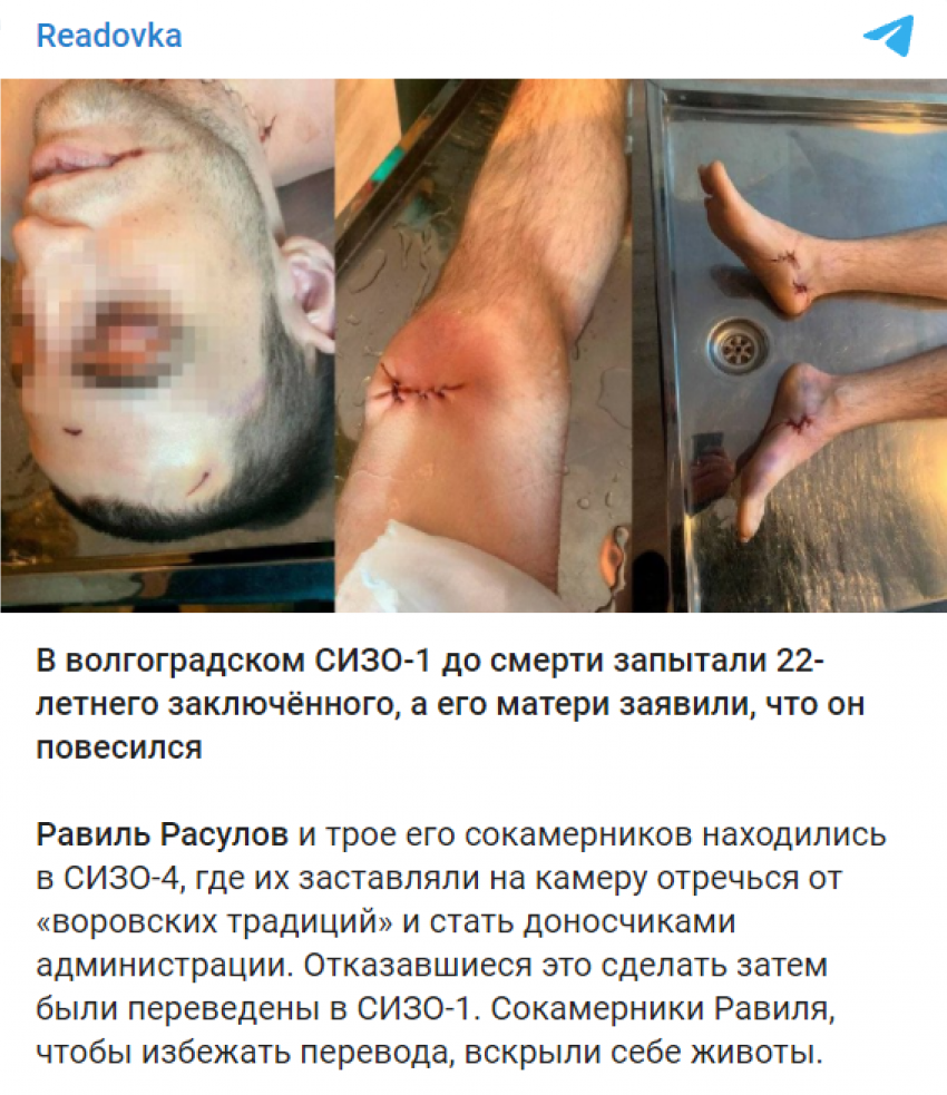 Журналисты опубликовали фото с последствиями пыток в волгоградском СИЗО, - «Блокнот Волгограда"